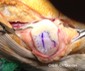 Dr Ch.Quintart-lsion chondrale rotule-rgnration cartilage genou