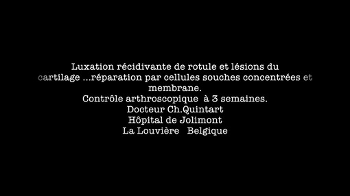 luxation-recidivante-de-la